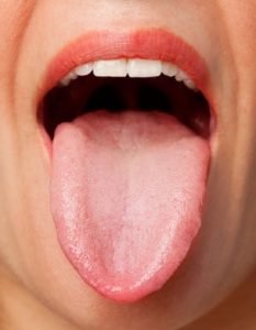 sore and reddish tongue