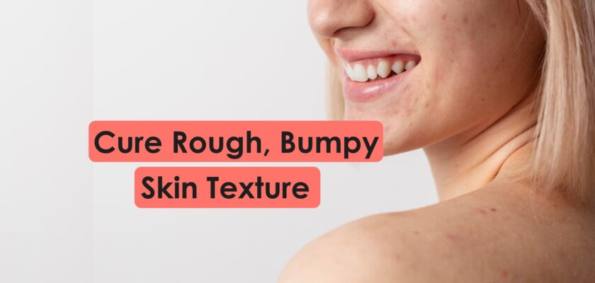 Cure rough bumpy dry grainy skin texture