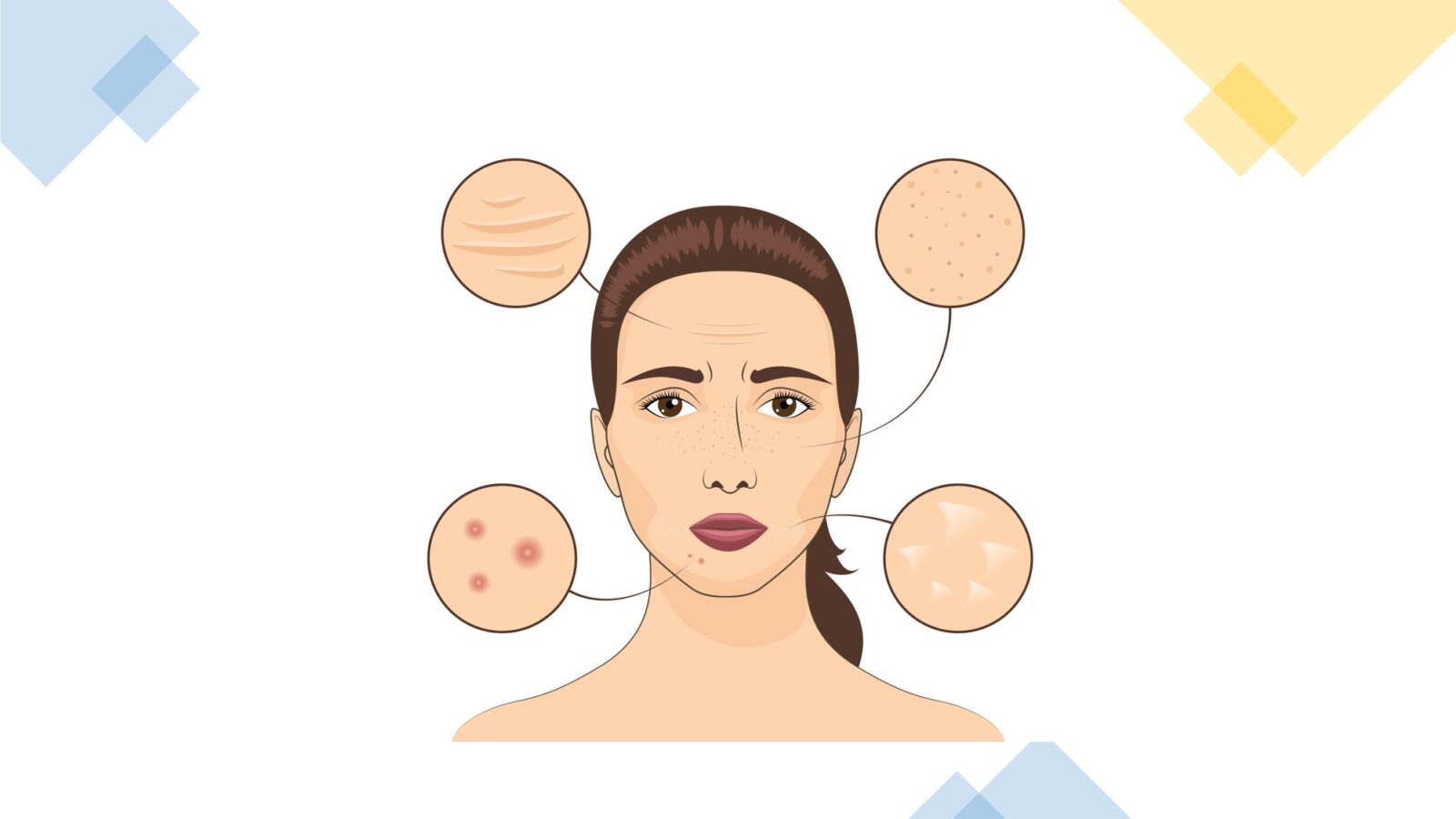 How to Improve Skin Texture: Grainy, Bumpy, Rough Skin