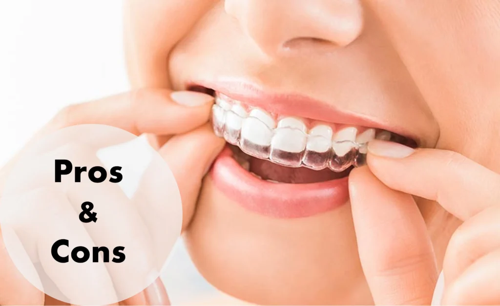 Invisalign Pros and Cons